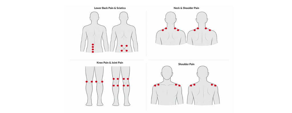 The Ultimate TENS Unit Placement Guide: Where to Put the Pads for Maxi ...